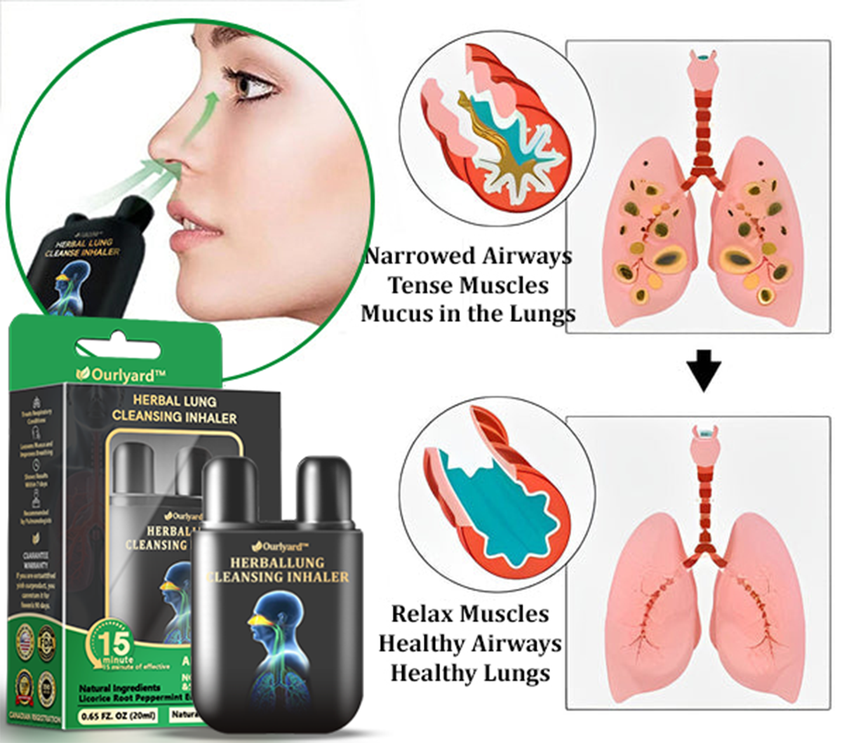 đŚâ
Official Store|Ourlyard⢠Herbal Lung Cleansing Inhaler(đ Cough, wheezing, shortness of breath, sputum, stuffy nose, bronchitis, bronchitis, allergy symptoms, lung discomfortđ)
