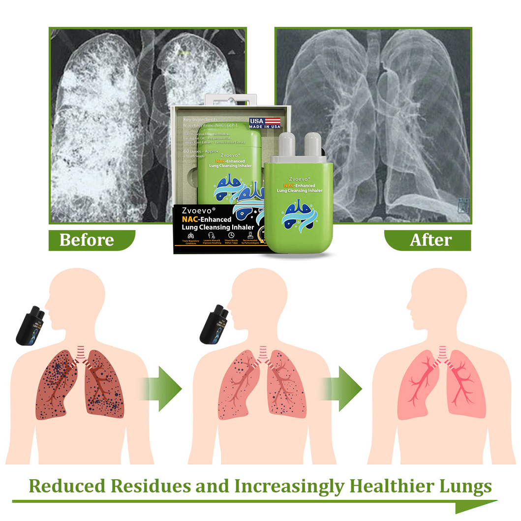 ✅Official Store|Zvoevo® NAC-Enhanced Lung Cleansing Inhaler(💝American Owned and Operated💝)