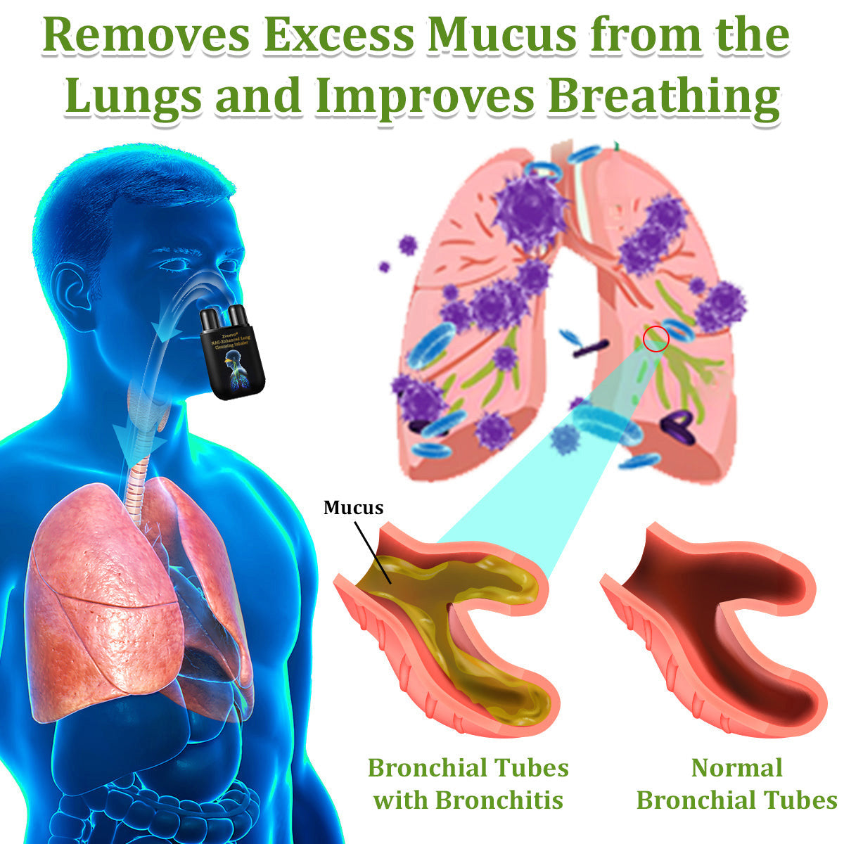 ✅Official Store|Zvoevo® NAC-Enhanced Lung Cleansing Inhaler(🫁Sinusitis,cough, wheezing, shortness of breath, sputum, stuffy nose, bronchitis, allergy symptoms, lung discomfort🫁)