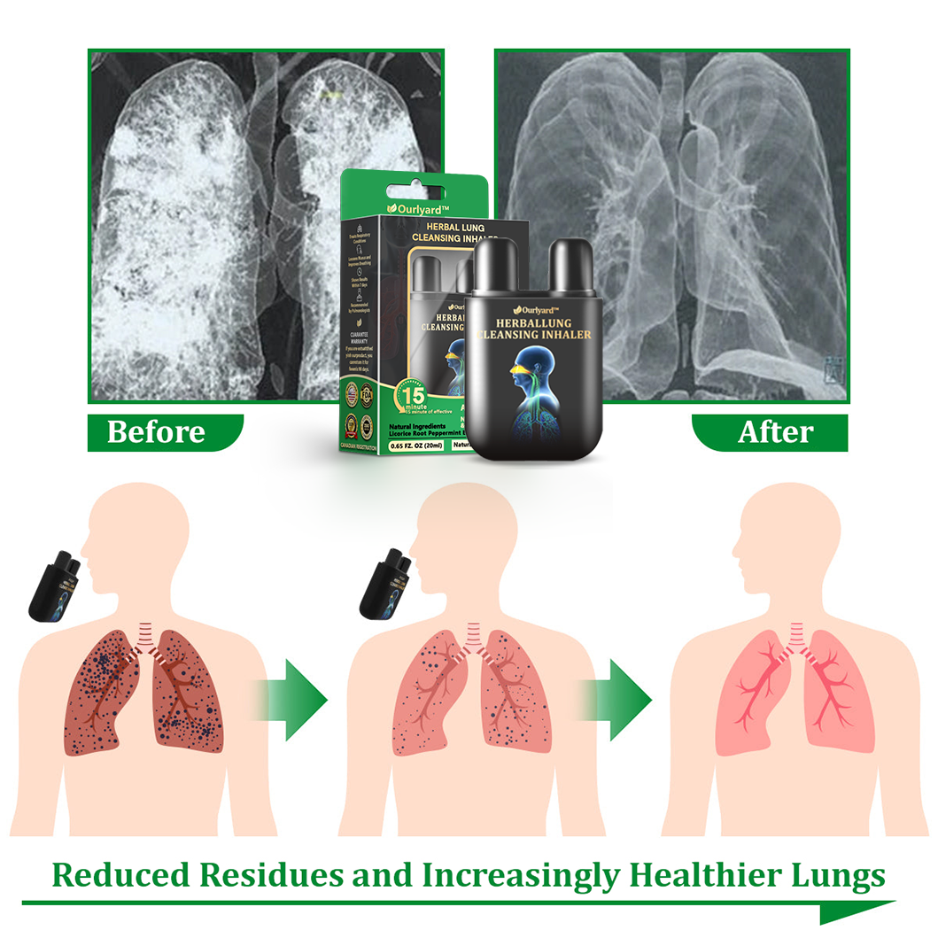 🦙✅Official Store|Ourlyard™ Herbal Lung Cleansing Inhaler(💝 Cough, wheezing, shortness of breath, sputum, stuffy nose, bronchitis, bronchitis, allergy symptoms, lung discomfort💝)