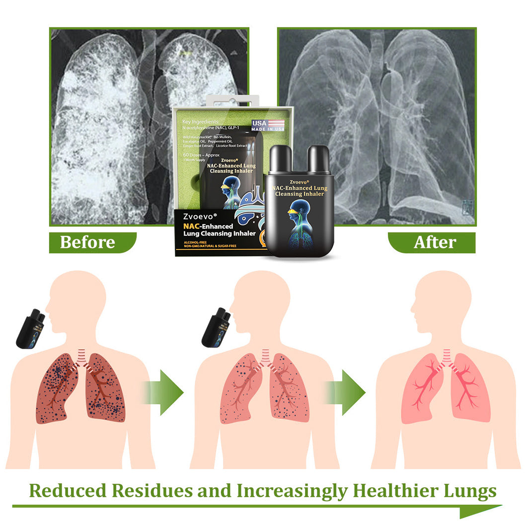 ✅Official Store|Zvoevo® NAC-Enhanced Lung Cleansing Inhaler(🫁Sinusitis,cough, wheezing, shortness of breath, sputum, stuffy nose, bronchitis, allergy symptoms, lung discomfort🫁)
