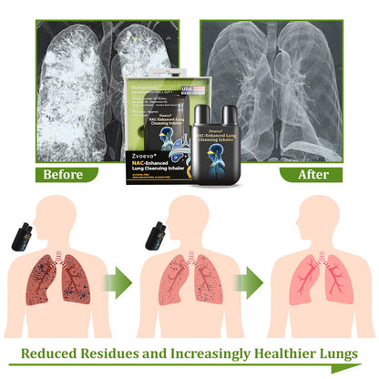 ✅Official Store|Zvoevo® NAC-Enhanced Lung Cleansing Inhaler(🫁Sinusitis,cough, wheezing, shortness of breath, sputum, stuffy nose, bronchitis, allergy symptoms, lung discomfort🫁)